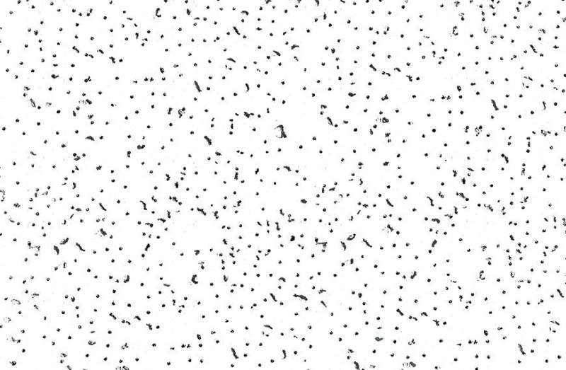 USG Radar — görsel 2